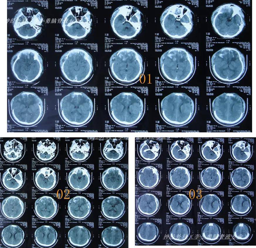 坡城遭险与利，比擦场战绩额皮